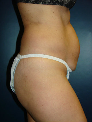 megan 2 before