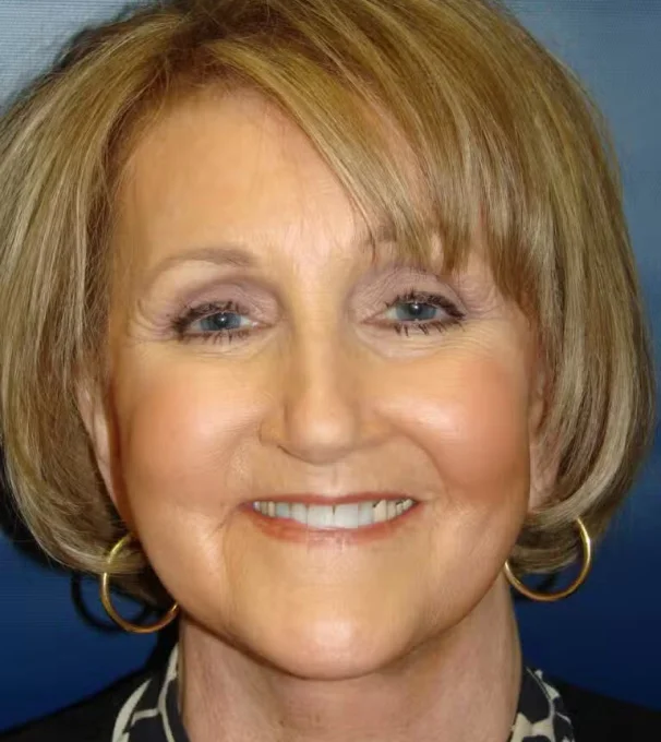 Real patient results in Evansville, IN Conkright Aesthetics